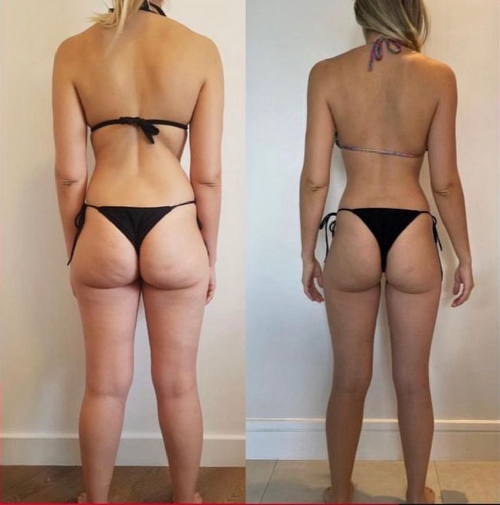 Antes e depois de aluno do Vitor Bizzo